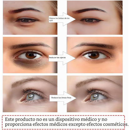 Gafas de terapia con Luz Roja